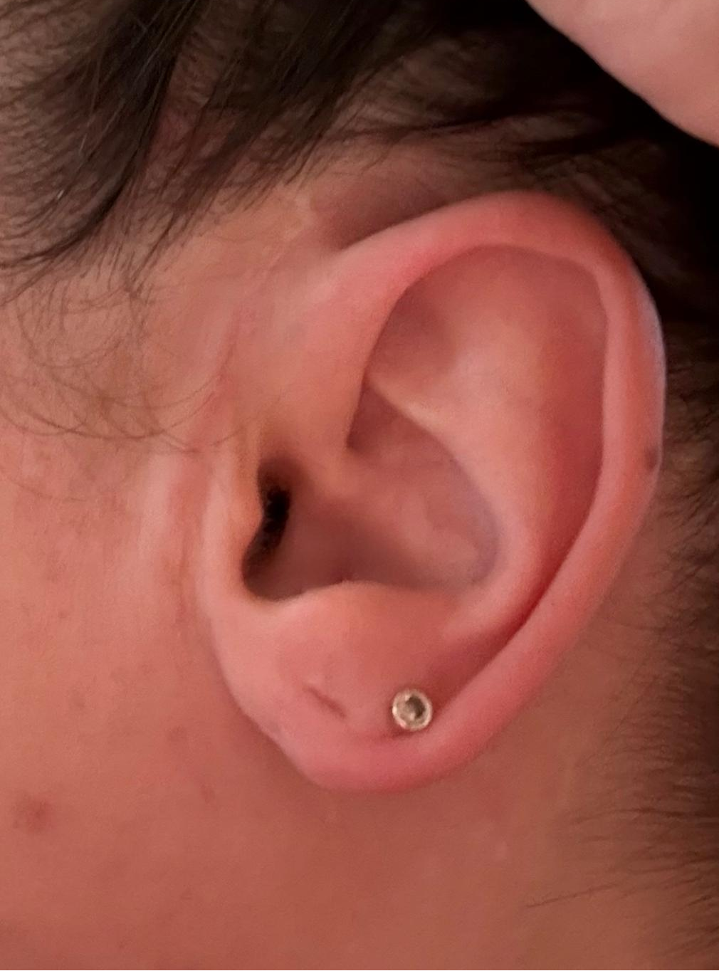 Close-up of an ear with healed surgical site